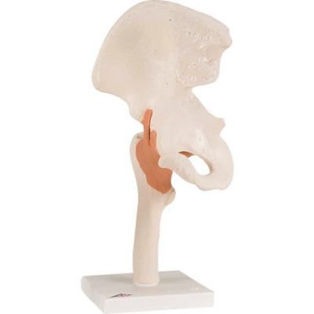 FABRICATION ENTERPRISES 3B® Anatomical Model - Functional Hip Joint 953619